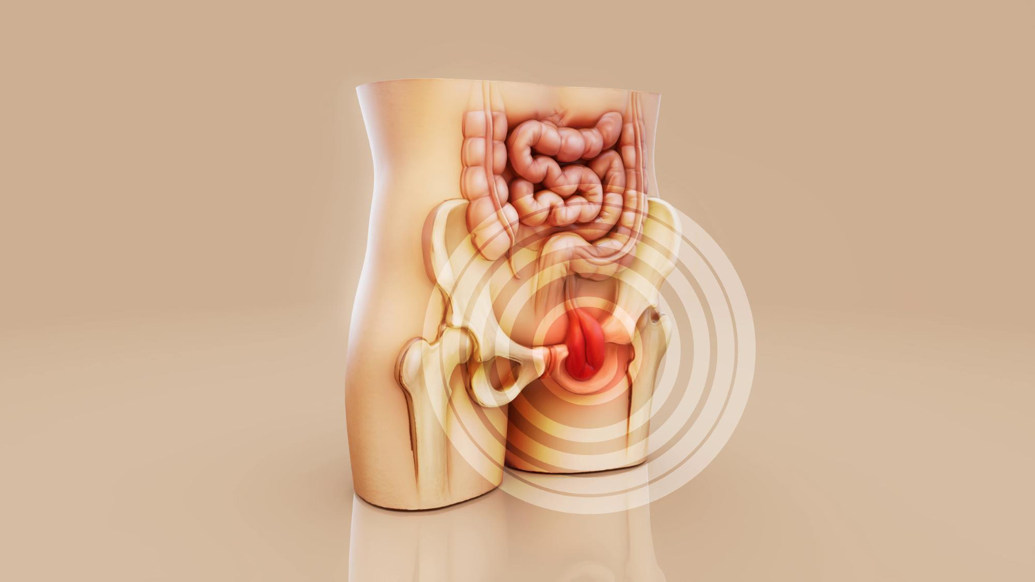 Hernias